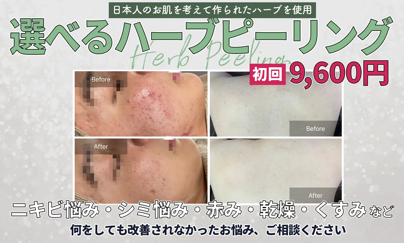 ハーブピーリング